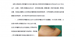 口腔頜面頭頸腫瘤外科特色醫(yī)療技術(shù)